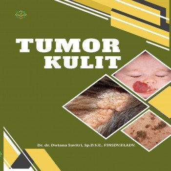 Tumor Kulit